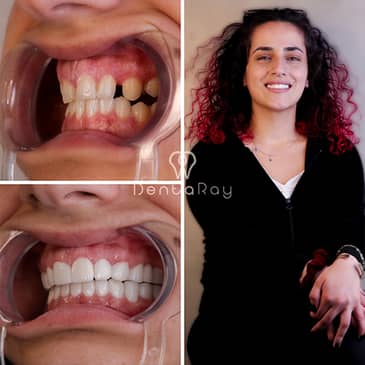 Slider image (8) Dentaray Clinic: luxury Dental Clinic in Istanbul
